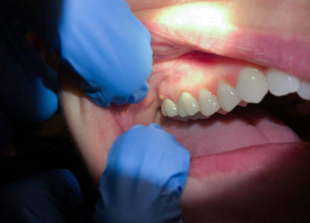 Best Emergency Dental Surgery in Sheridan, IL